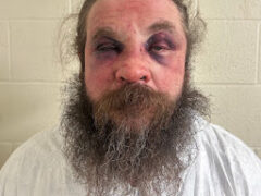 Fairfax man arrested for attempted murder in shooting incident, police say