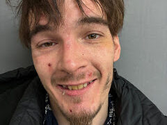 St. Johnsbury man arrested on warrant for animal cruelty, police say