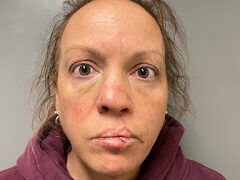 Tunbridge woman arrested for DUI after crash on VT Route 110, police say