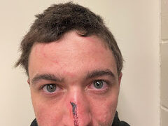 Salisbury man arrested for DUI and leaving the scene, police say