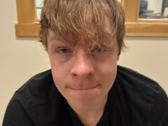 Starksboro man cited for DUI and gross negligent operation, police say