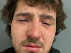 St. Johnsbury man cited for domestic assault, police say