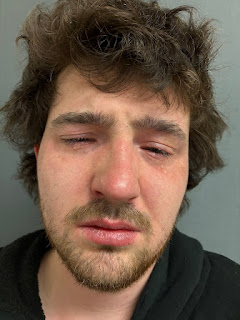 St. Johnsbury man cited for domestic assault, police say