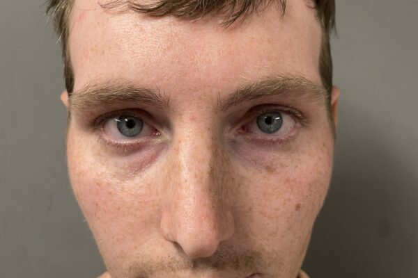 Proctor man cited for possession of heroin and DLS in Rutland, police say