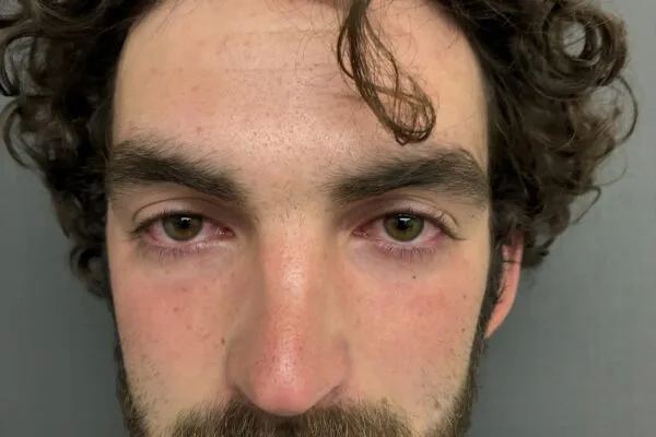 Lyndon man arrested for DUI after motor vehicle crash, police say