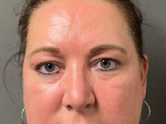 Rutland Town woman cited for domestic assault, police say