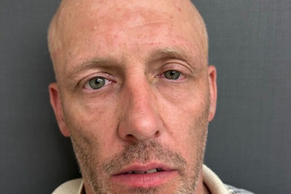 St. Johnsbury man arrested for DUI after erratic driving, police say